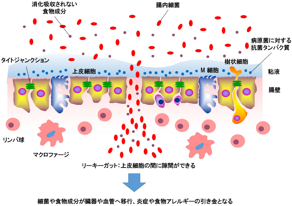 脂多糖（LPS）对肠漏症患者安全吗？