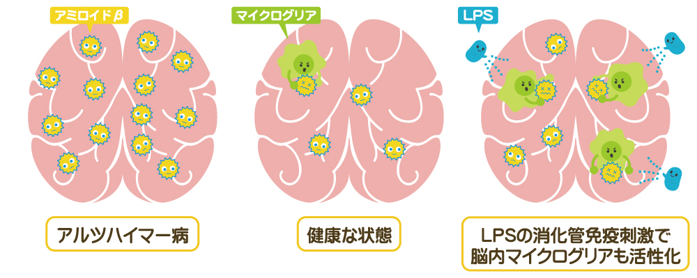 LPS还能延缓衰老！它与阿尔茨海默病和免疫力有什么关系？
